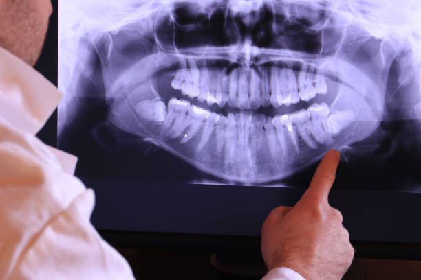 Urgent Tooth Repair in NJ